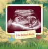 Life Before Birth - Baby Photo Book